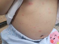 -卡拉卡拉漫温泉汗蒸