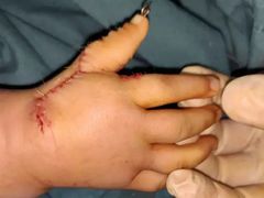 -华中科技大学同济医学院附属协和医院(主院区)