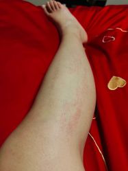 体验后-上海玫瑰医疗美容医院