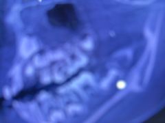 -土豆口腔(凤凰北总店)