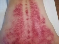 -脊艾堂正骨·推拿(牛王庙店)