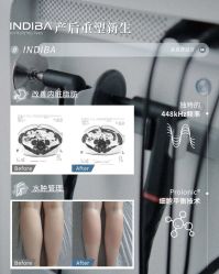 -半岛故事·法儿曼抗衰·indiba中心