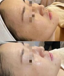 -SKIN79皮肤管理中心