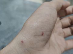 -苏州市立医院(白塔院区)