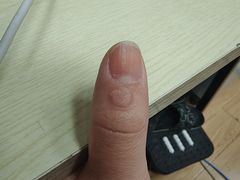 -上海市皮肤病医院(武夷路院区)