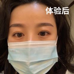 体验后-南京医科大学友谊整形外科医院