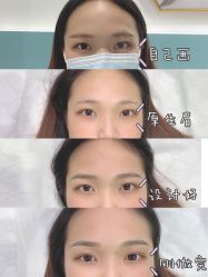 -久匠半永久纹眉