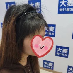 点击看大图 -大麦微针植发丨全国连锁