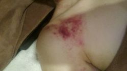 android_upload_pic-紫御国际抗衰ZOE ANTI AGING