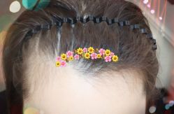 -大麦微针植发全国连锁