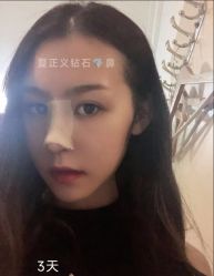 -北京米扬丽格医疗美容·联合丽格鼻整形中心