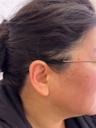 -长沙雅美医疗美容医院
