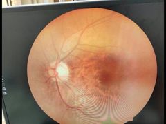 -宝岛眼镜(昆山前进店)