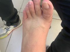 -新甲连锁灰指甲·甲沟炎·鸡眼(黑龙江路店)