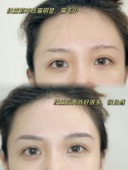-张小野·专业半永久纹眉