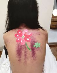 -苑苑vbeauty科技美容SPA