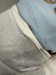 -悟空祛痘·诺奖技术专业店