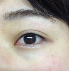 半永久隐形眼线-平萍纹绣韩式半永久定妆