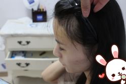 -大麦微针植发丨全国连锁