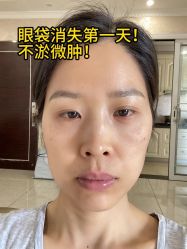 -广州健丽·去眼袋医疗美容机构