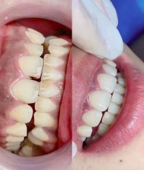 -美朵纹绣美牙纹眉工作室