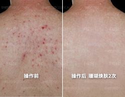 -苗方清颜痘肌研究所