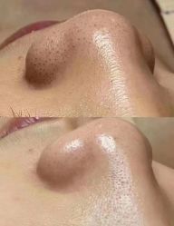-+MS卓美丝专业祛痘·皮肤管理中心