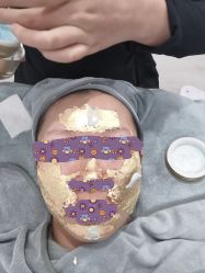 体验后-skin79皮肤管理中心