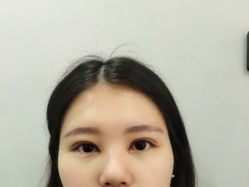-八大处整形