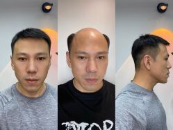 -型男帮男士假发补发·佩戴式发型