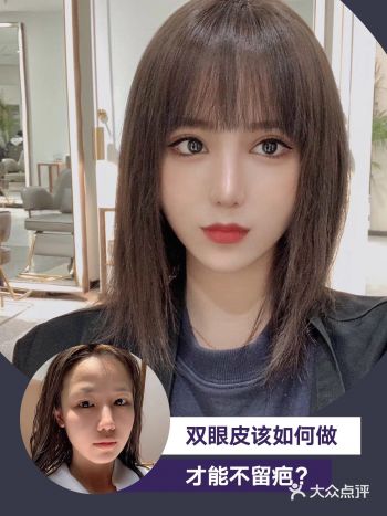 双眼皮如何做才能不留疤