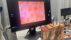 -悟空祛痘·诺奖技术专业店