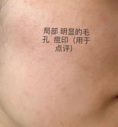 点击看大图 体验前-南京康美美容医院·旗舰店