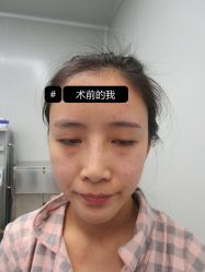 -素美医疗美容·西南眼鼻整形·修复基地