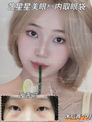 -Yestar重庆艺星医疗美容医院