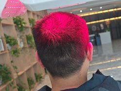 点击看大图 -碧莲盛·不剃发植发