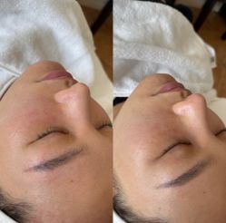 -美愈美肤MEIYU SKIN