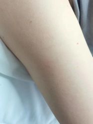 -清疣美疣·痣·斑净肤中心