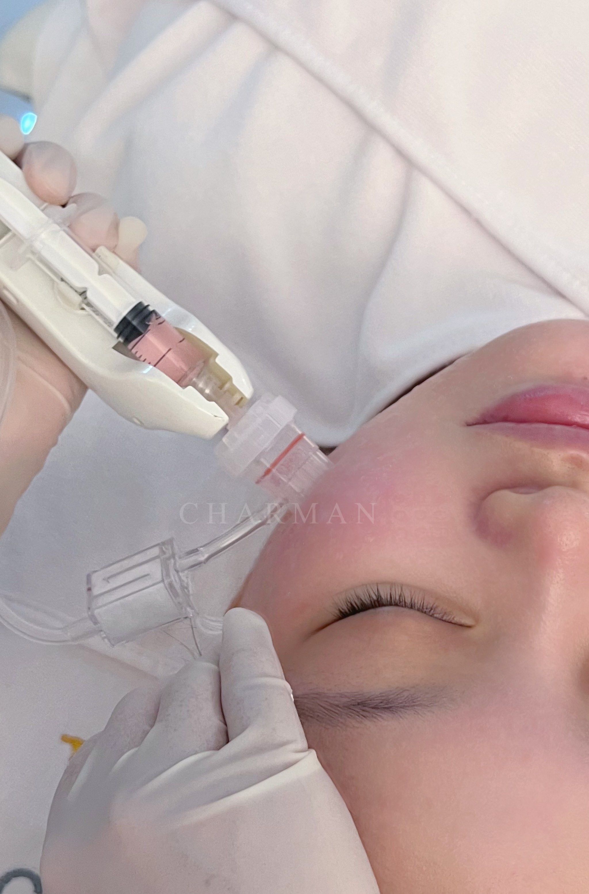 一定要打水光针
水光针的光泽度和晶莹