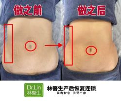点击看大图 -Dr.林醫生产后修复·配方产康店(南京大厂店)