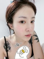 体验后-丰联丽格医疗美容·联合丽格眼整形中心