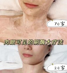 -VE专注问题肌·赛诺龙&科学美肤中心