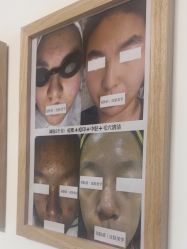 -美肤盾祛痘·问题肌头疗管理中心