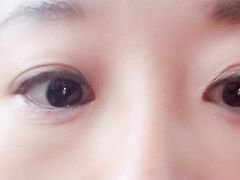 体验后-上海华安整形外科门诊部