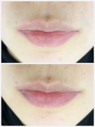 -植蔻妍倍儿专业脱毛·皮肤管理