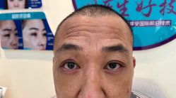 -万州华美紫馨整形美容医院