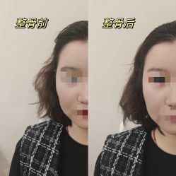 -颜和骨正·明哲式骨相美学整骨