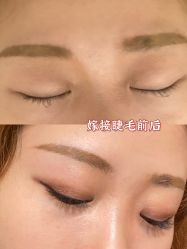-宥莉·ULLY 痘敏肌•科技皮肤管理中心