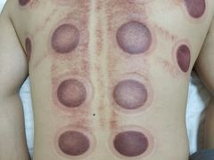 -1号足道推拿会馆