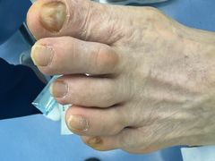 -Andrew指甲专科灰指甲·甲沟炎矫正·3D步态矫形鞋垫定制(浦三路店)